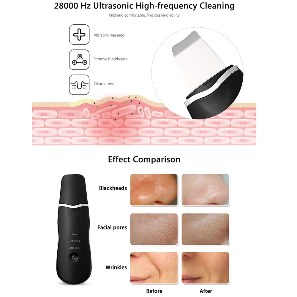 Premium ULTRASONIC Skin Scrubber